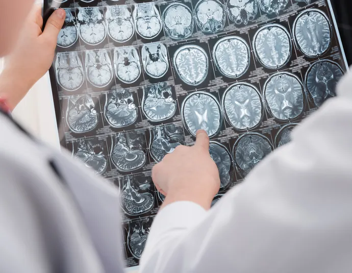 Афиша трансляции "Научные бои": врач Людмила Легостаева – о стимуляции мозга